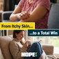 From itchy skin to a total win with NOPE! Flea Killer Spray.