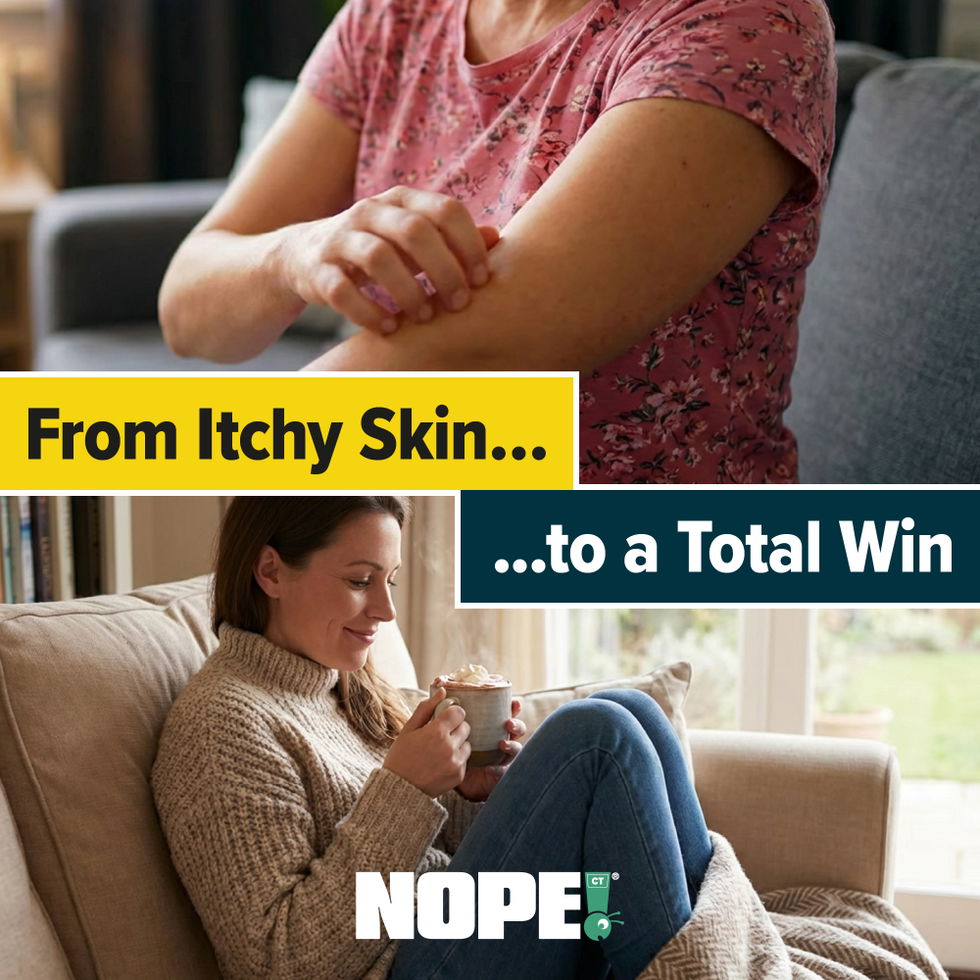 From itchy skin to a total win with NOPE! Flea Killer Spray.